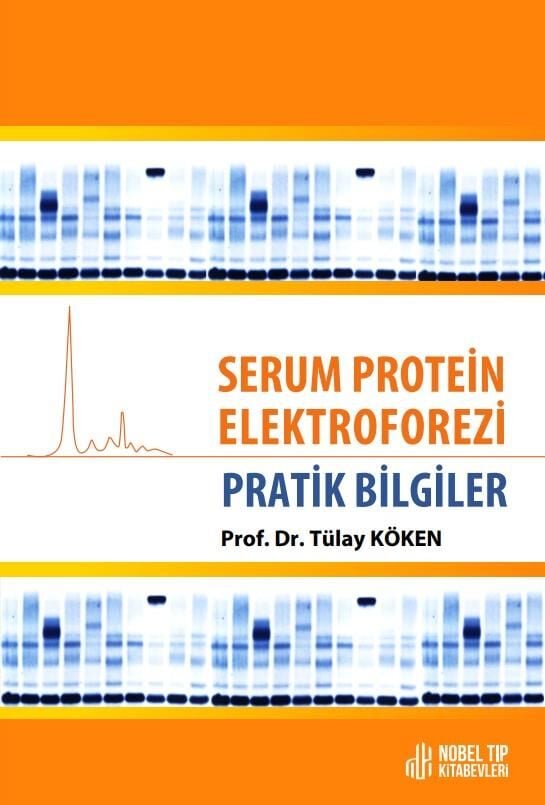 Serum Protein Elektroforezi: Pratik Bilgiler