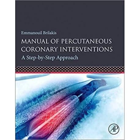 Manual of Percutaneous Coronary Interventions: A S