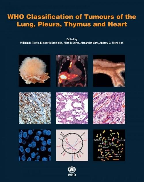 WHO Classification of Tumours of the Lung, Pleura,