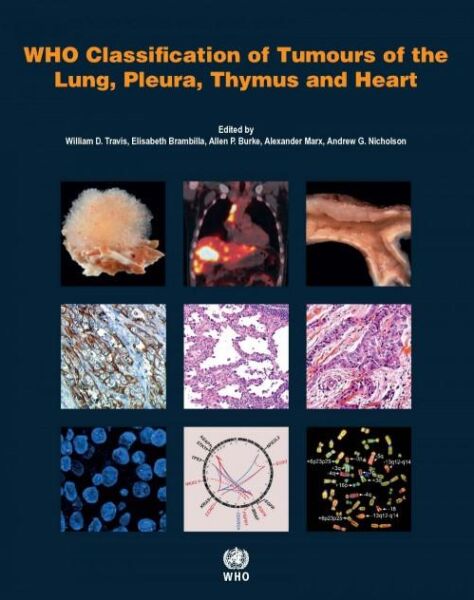 WHO Classification of Tumours of the Lung, Pleura,