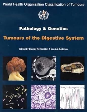 Who Pathology of The Genetics Tumors of Endocrine