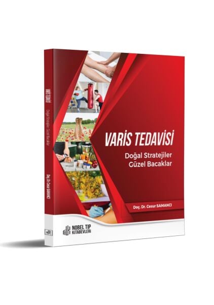 Varis Tedavisi Doğal Stratejiler,Güzel Bacaklar