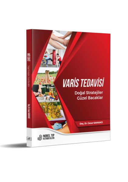 Varis Tedavisi Doğal Stratejiler,Güzel Bacaklar