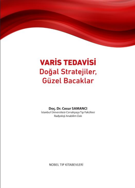 Varis Tedavisi Doğal Stratejiler,Güzel Bacaklar