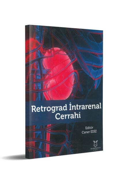 Retrograd İntrarenal Cerrahi
