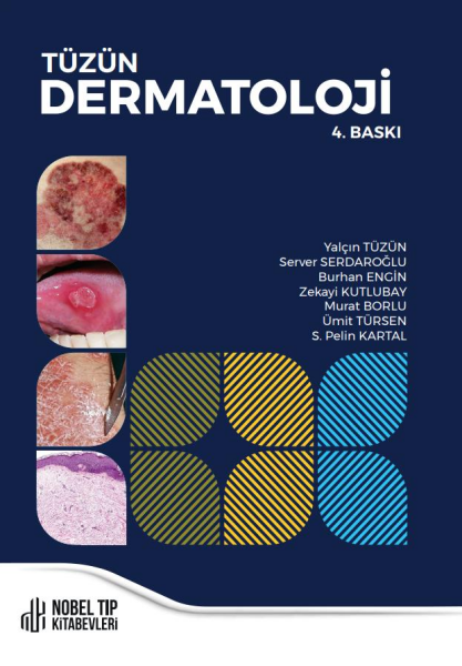 Tüzün Dermatoloji 4.Baskı