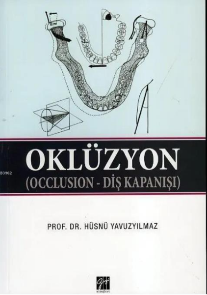 Oklüzyon