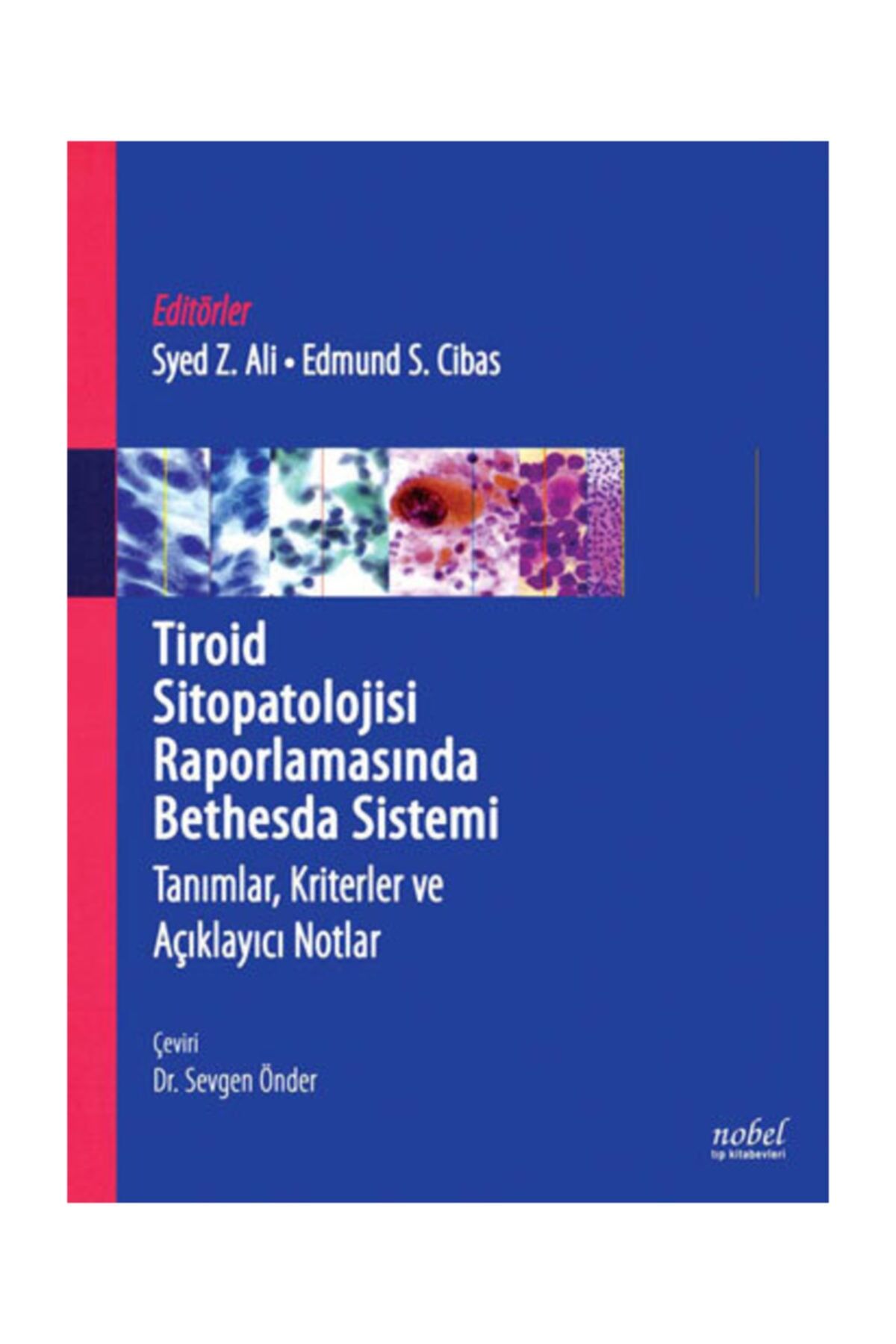 Tiroid Sitopatolojisi Raporlamasında Bethesda Sistemi: Tanımlar, Kriterler ve Açıklayıcı Notlar