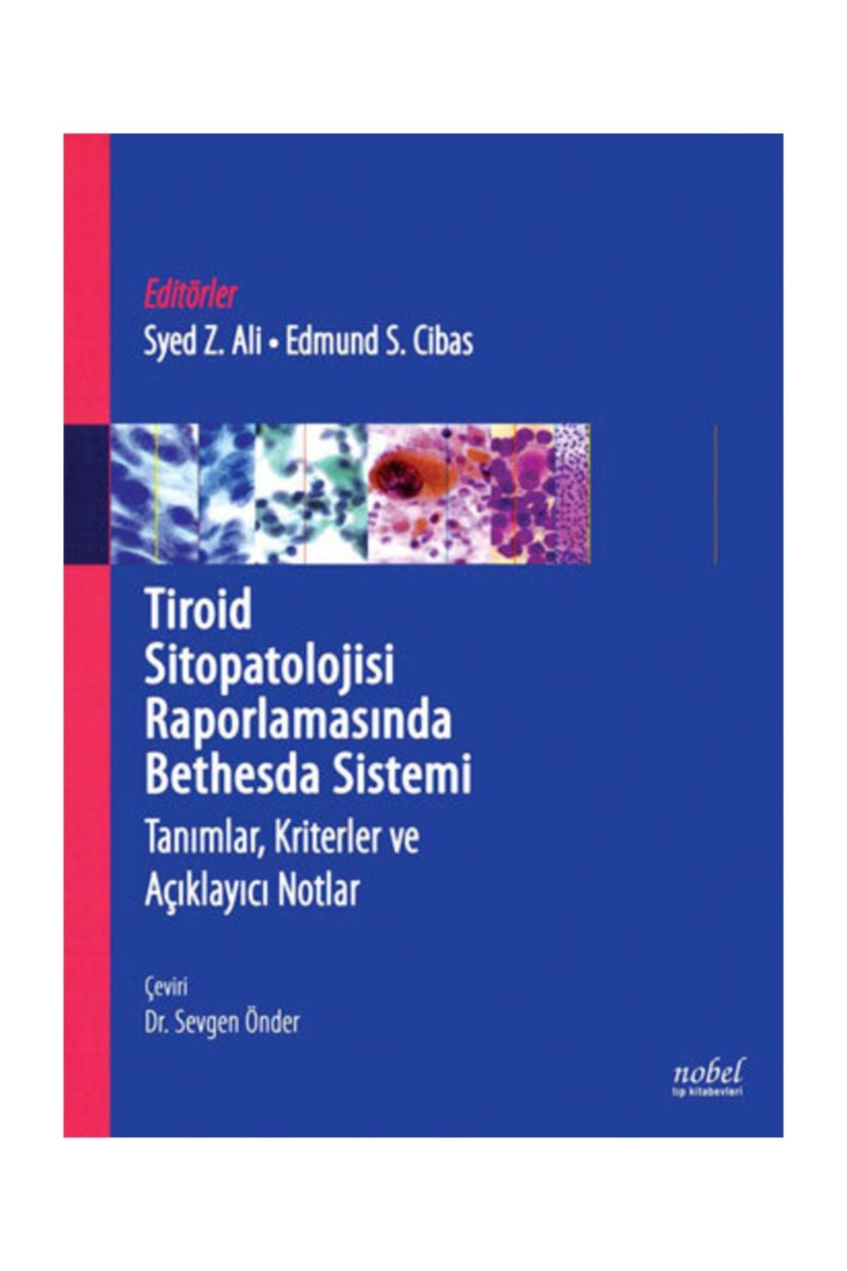 Tiroid Sitopatolojisi Raporlamasında Bethesda Sistemi: Tanımlar, Kriterler ve Açıklayıcı Notlar