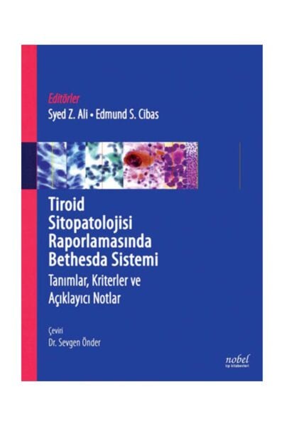 Tiroid Sitopatolojisi Raporlamasında Bethesda Sistemi: Tanımlar, Kriterler ve Açıklayıcı Notlar