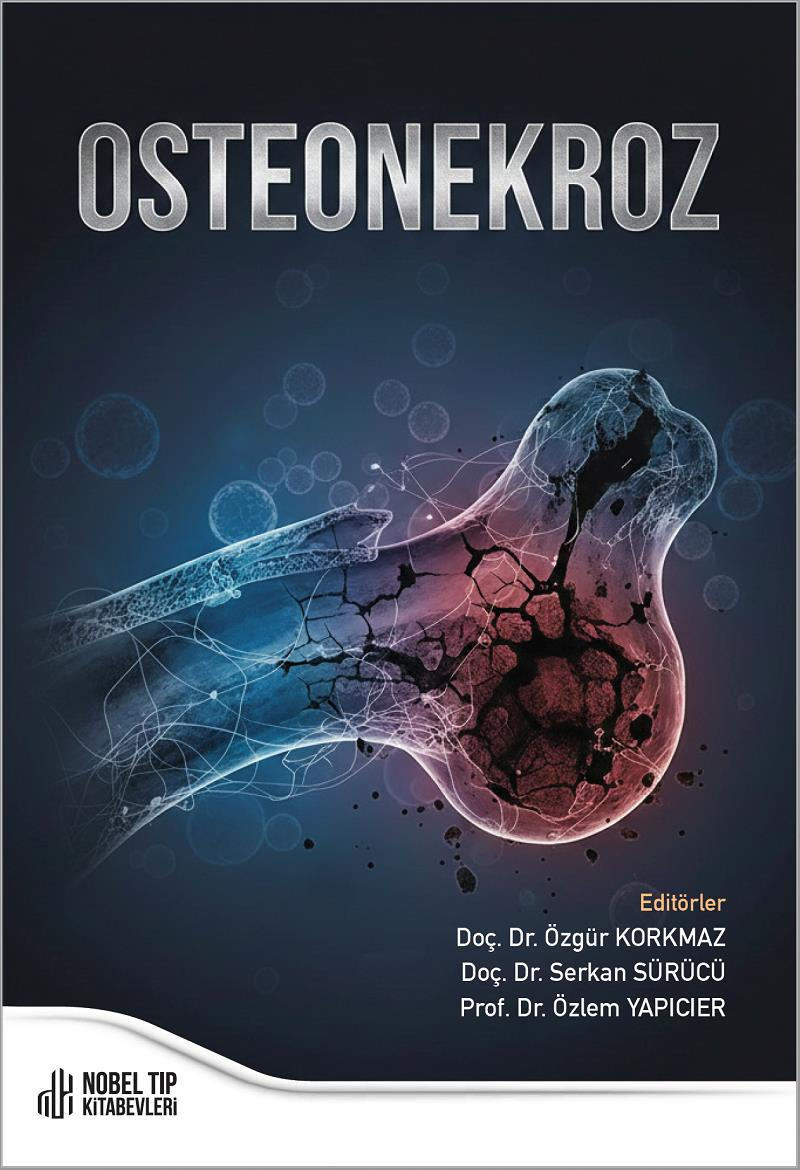 Osteonekroz