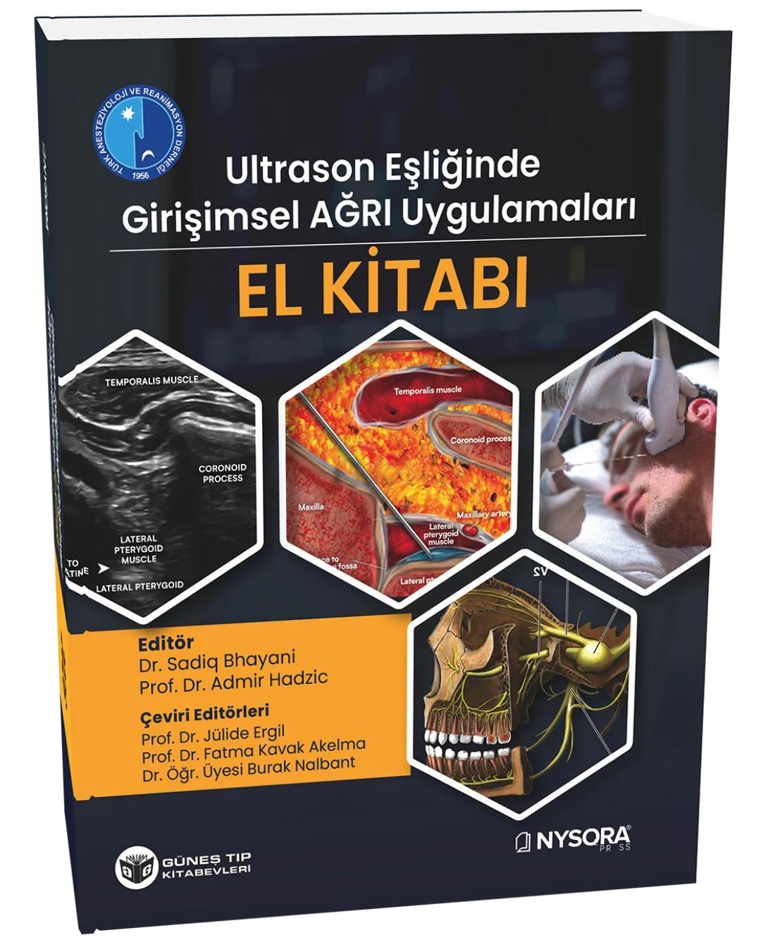 NYSORA - Ultrason Eşliğinde Girişimsel Ağrı Uygula