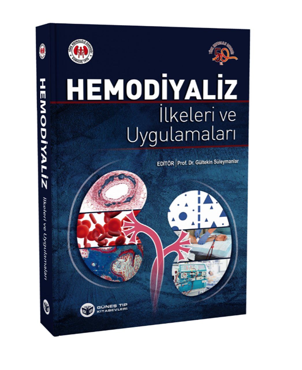 Hemodiyaliz İlkeleri ve Uygulamaları
