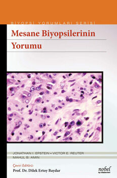 Mesane Biyopsilerinin Yorumu - Biyopsi Yorumları Serisi