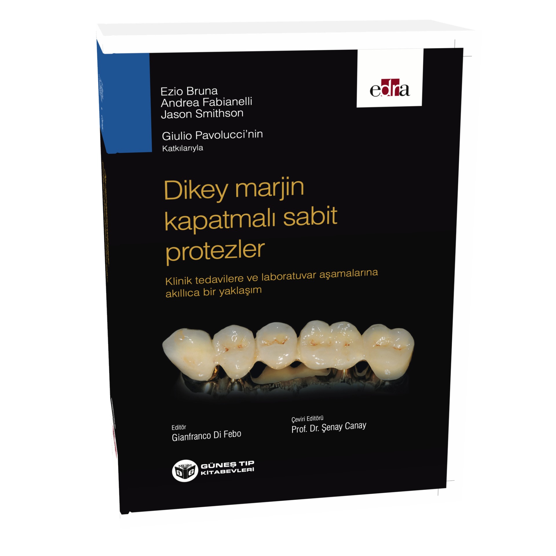 Dikey Marjin Kapatmalı Sabit Protezler