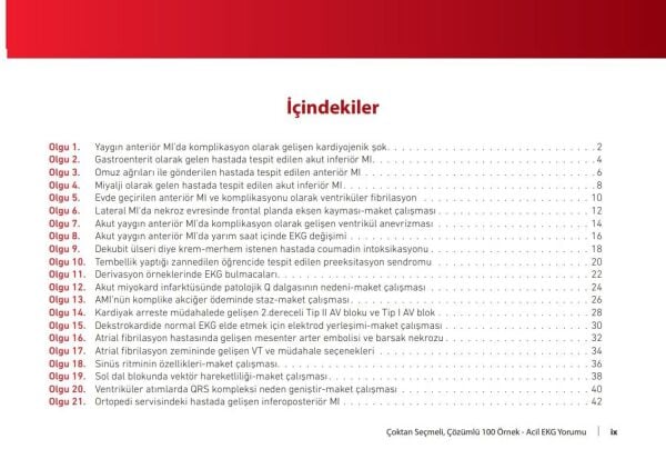 Çoktan Seçmeli Çözümlü 100 Örnek Acil EKG Yorumu