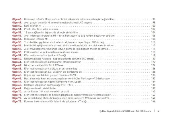 Çoktan Seçmeli Çözümlü 100 Örnek Acil EKG Yorumu