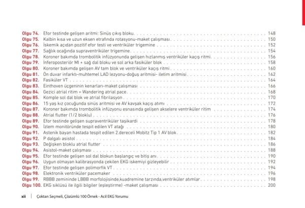 Çoktan Seçmeli Çözümlü 100 Örnek Acil EKG Yorumu