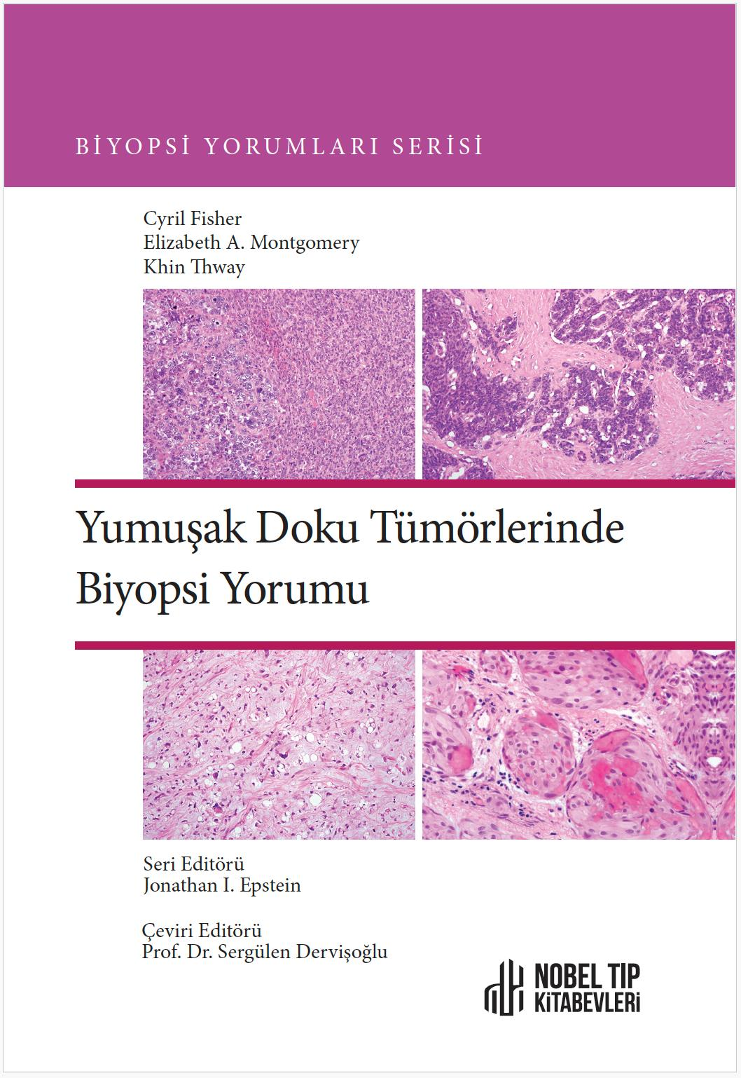 Biyopsi Yorumları Serisi Yumuşak Doku Tümörlerinde Biyopsi Yorumu
