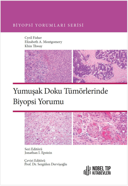 Biyopsi Yorumları Serisi Yumuşak Doku Tümörlerinde Biyopsi Yorumu