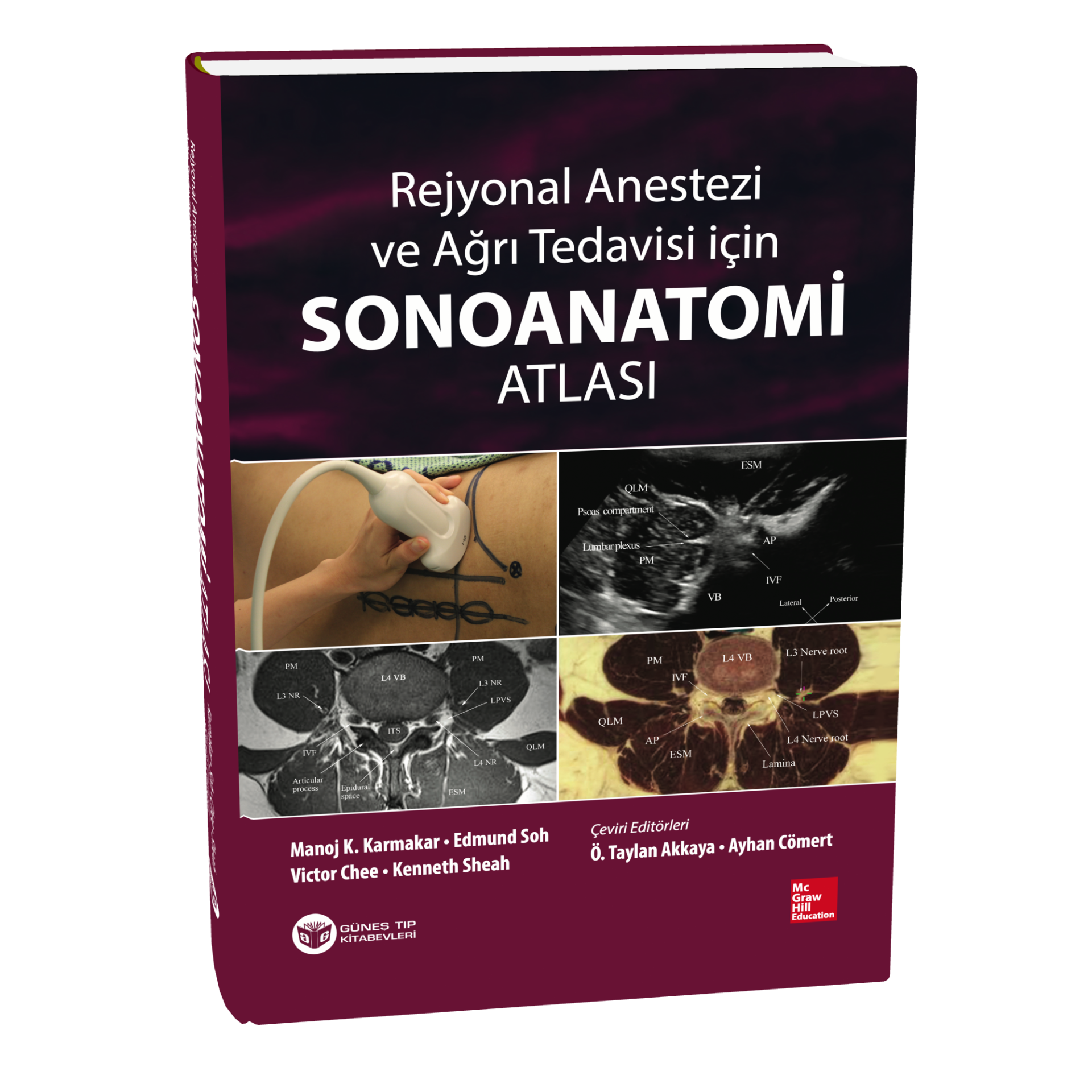 Rejyonal Anestezi ve Ağrı Tedavisi İçin Sonoanatomi Atlası