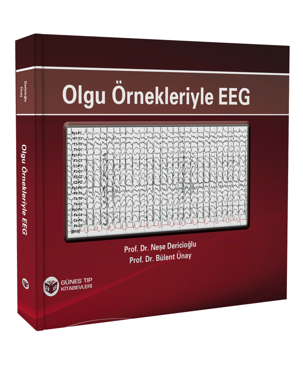 Olgu Örnekleriyle EEG