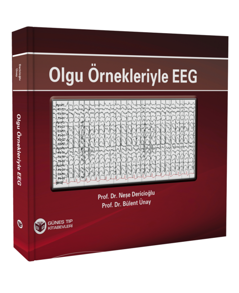 Olgu Örnekleriyle EEG