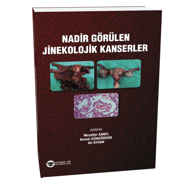 Nadir Görülen Jinekolojik Kanserler