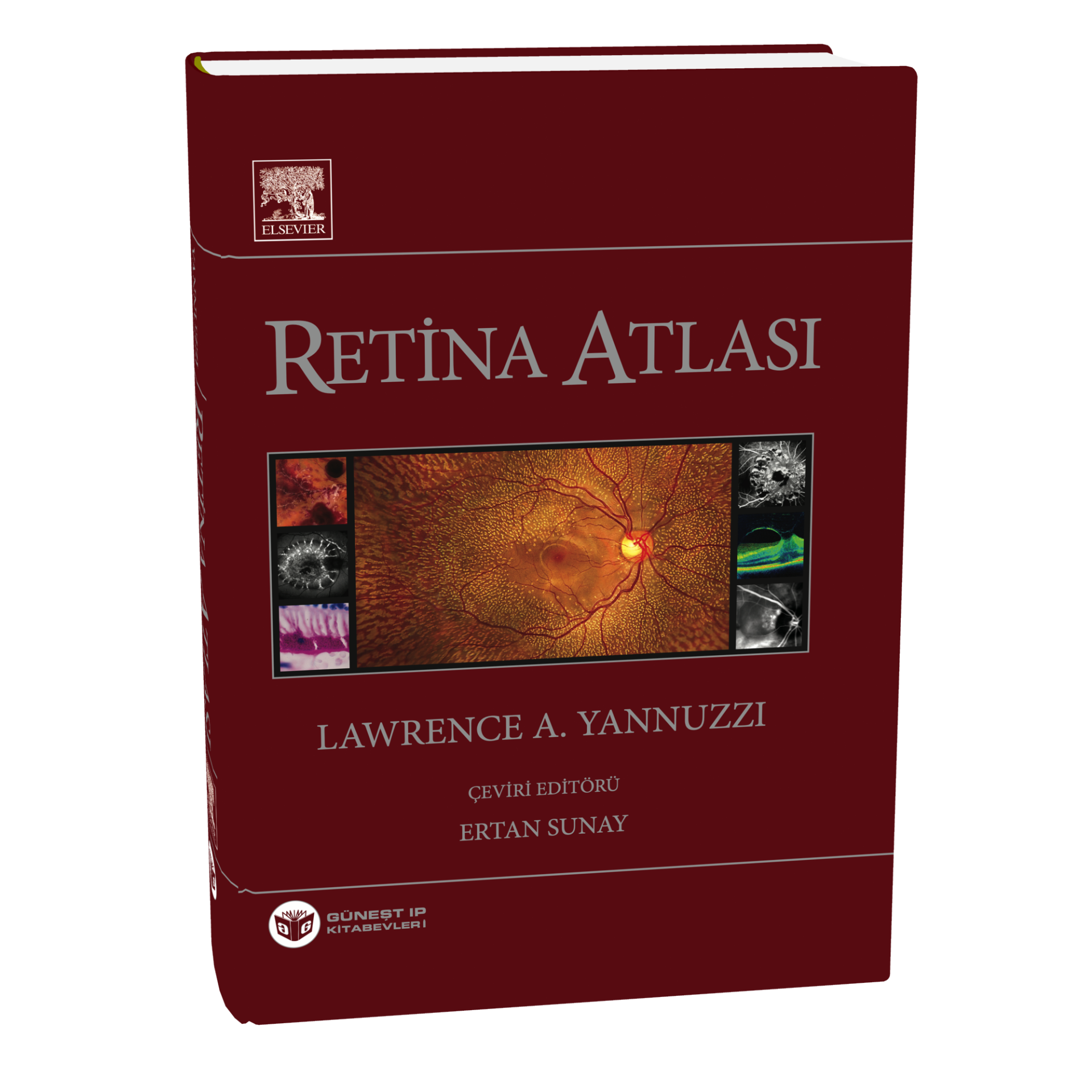 Yannuzzi Retina Atlası