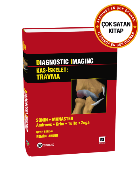 Diagnostic Imaging - Kas İskelet: Travma