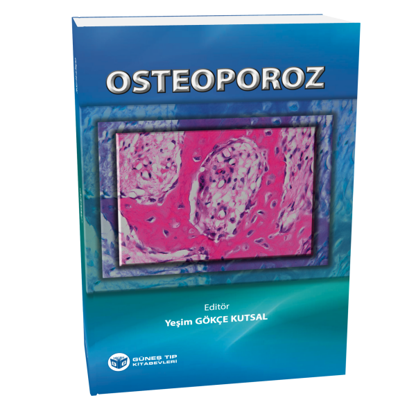 Osteoporoz