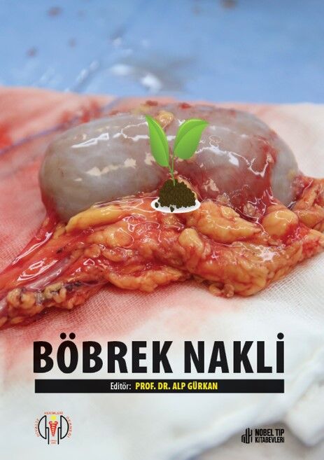 Böbrek Nakli