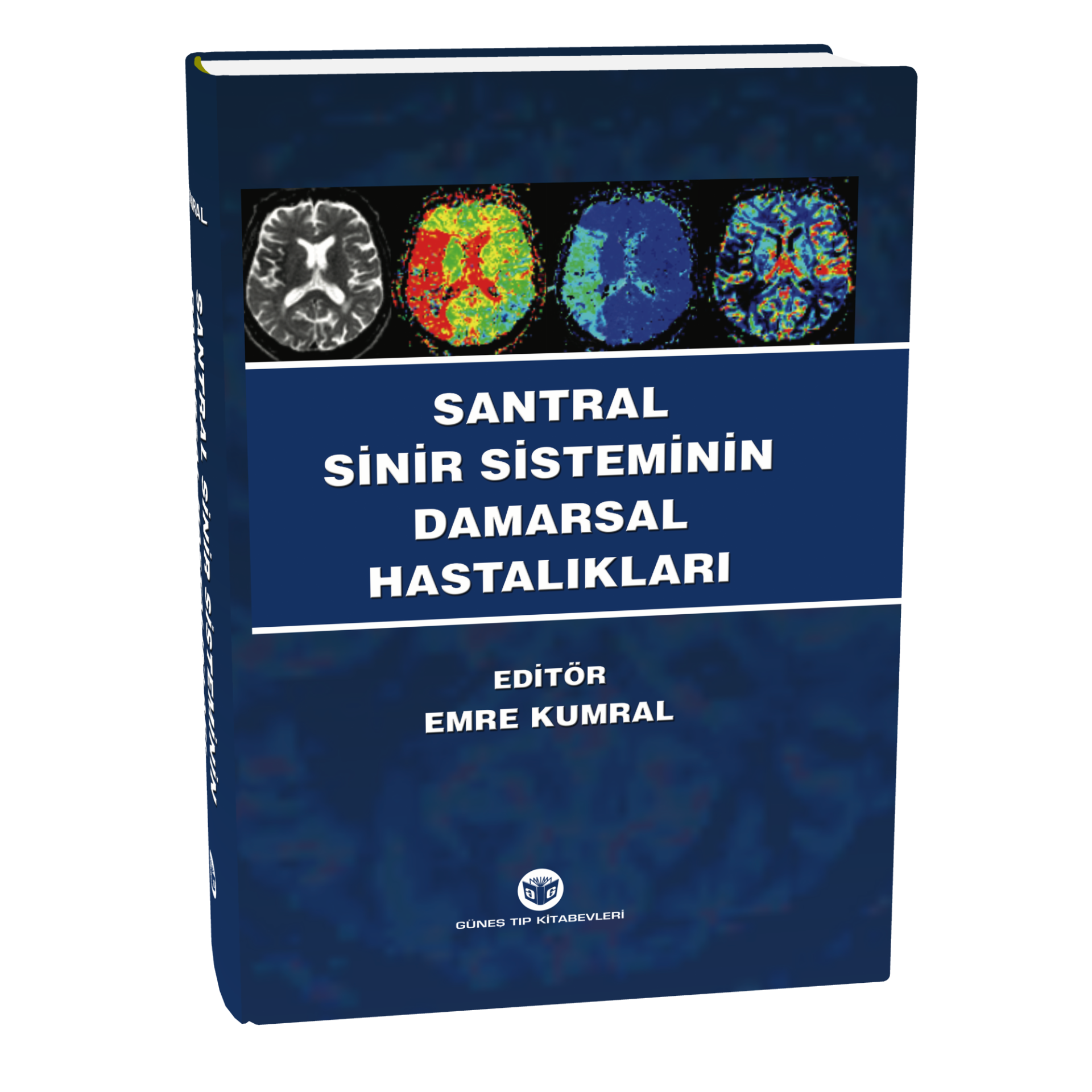 Santral Sinir Sisteminin Damarsal Hastalıkları