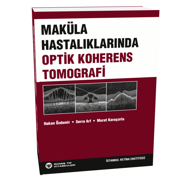 Maküla Hastalıklarında Optik Koherens Tomografi