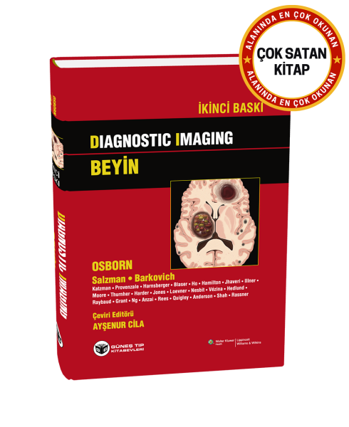 Diagnostic Imaging - Beyin