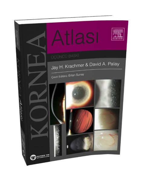 Krachmer Kornea Atlası