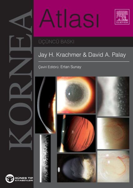 Krachmer Kornea Atlası