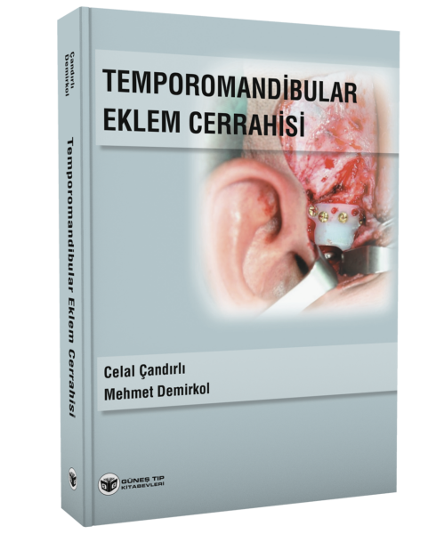 Temporomandibular Eklem Cerrahisi