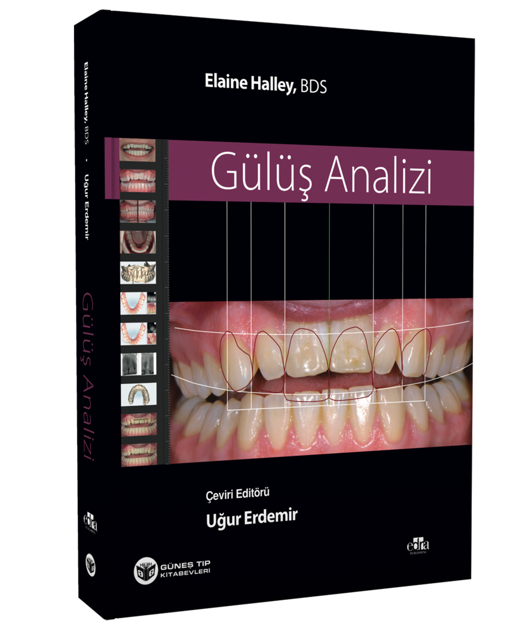 Gülüş Analizi